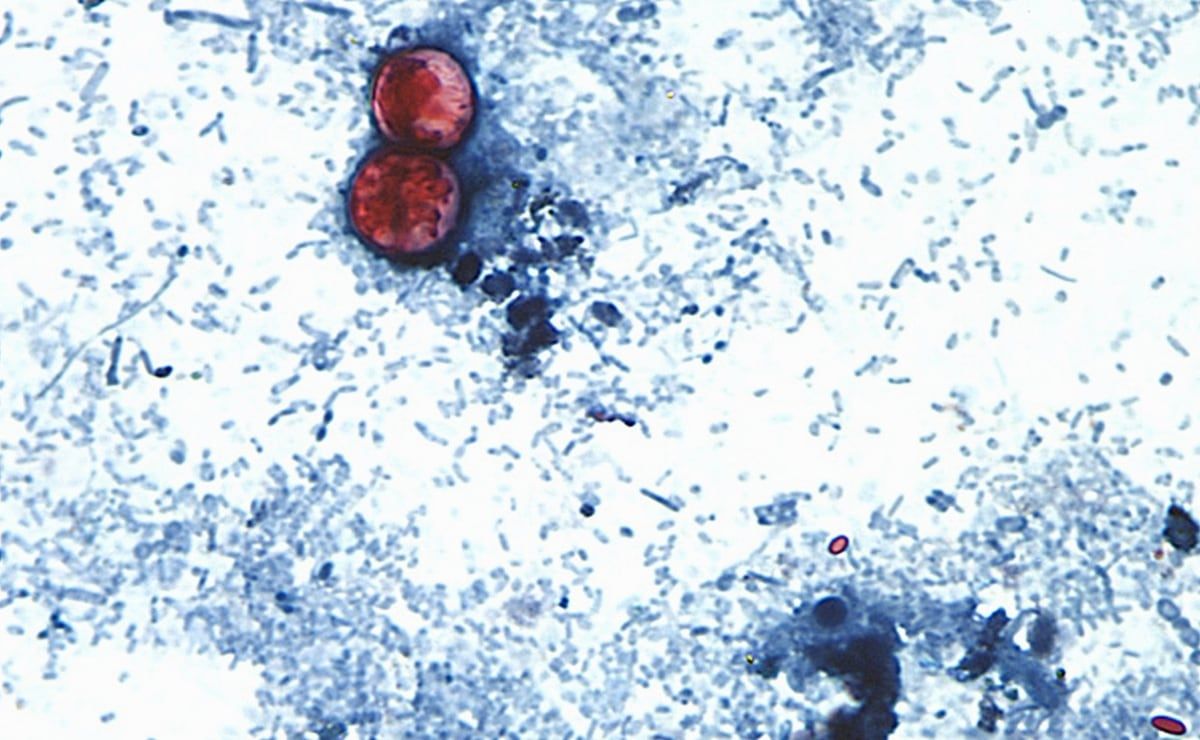 EU reporta dos muertes por ciclosporiasis en Michigan durante brote intestinal